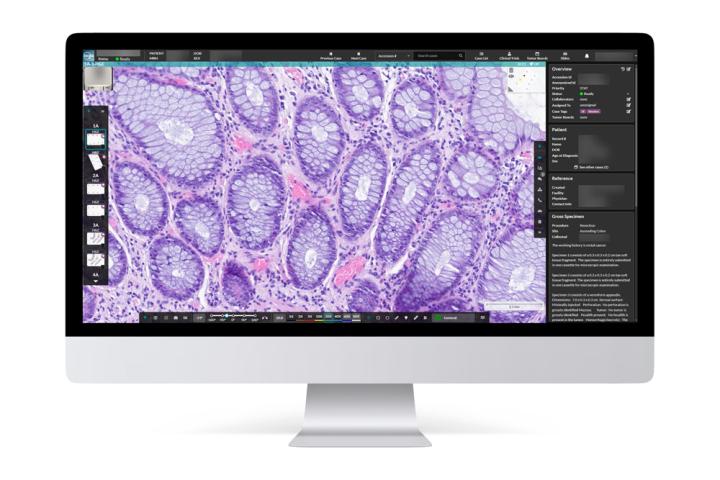 HALO-AP-Dx-Faster-Diagnoses