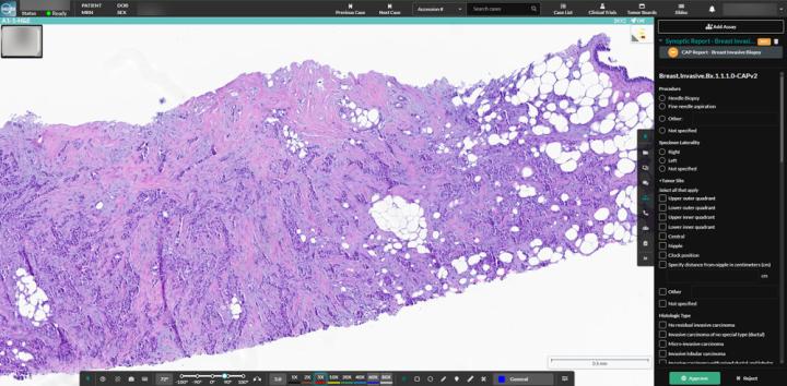 HALO-AP-Dx-Integrated-Reporting