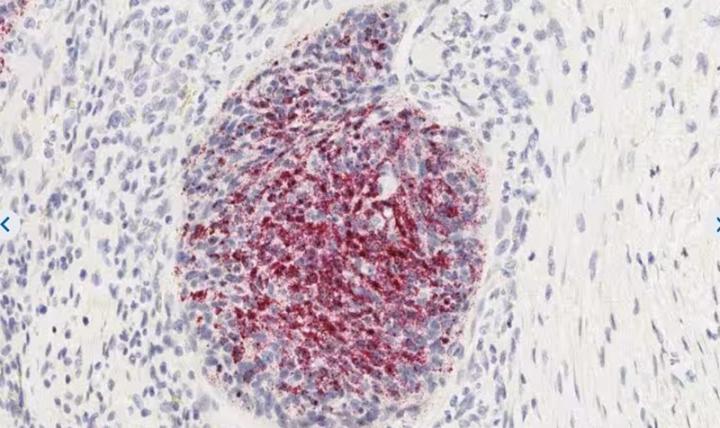 RNAscope-Single-Plex-new