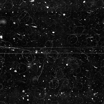 Film microscope slide coverslips exhibit significantly more surface artifacts, including multiple scratches, than glass coverslips