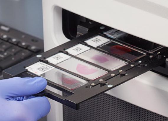 Glass coverslips on microscope slides demonstrate greater consistency and performance than film coverslips