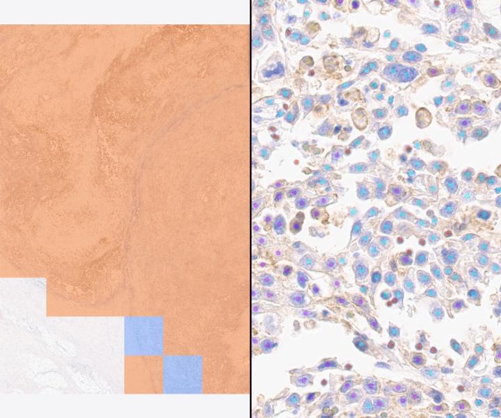 Lunit SCOPE PD-L1 22C3 Bladder (RUO)