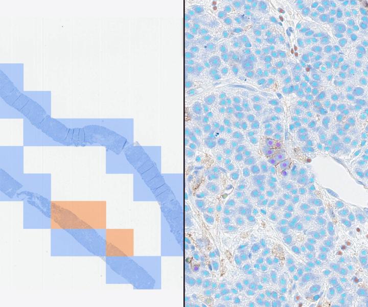 Lunit SCOPE PD-L1 22C3 Pan-cancer (RUO)