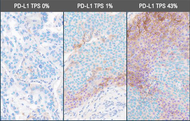 Lunit-SCOPE-PD-L1-CAL10-NSCLC-PD-L1-Scoring-Range