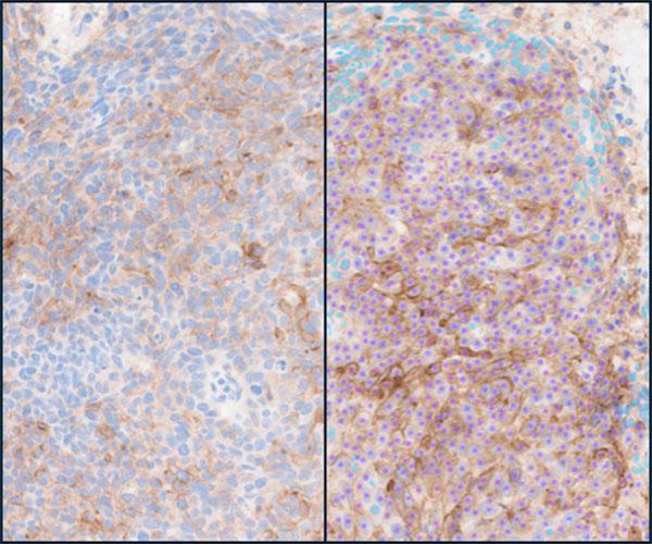 Lunit-SCOPE-PD-L1-CAL10-NSCLC-Positive-Negative