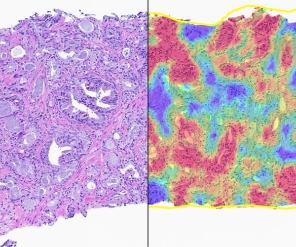 Prostate Macrodissect AI