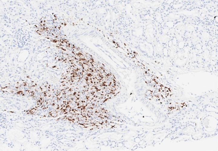 EBER RNAscope staining performed on the BOND-III automated staining platform