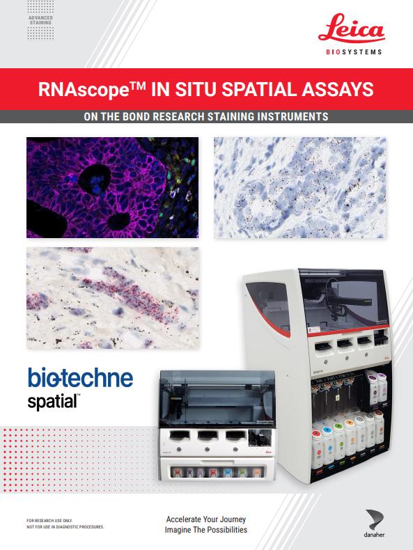 RNAscopeTM-IN-SITU-SPATIAL-ASSAYS