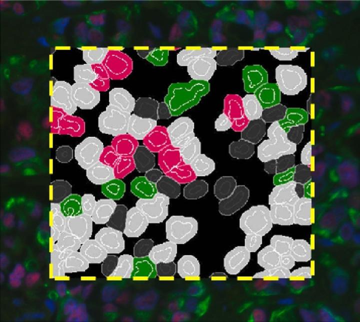 Algoritmo Aperio de IF celular: análisis cuantitativo de inmunofluorescencia celular