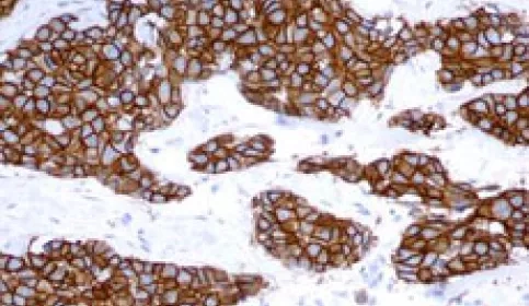 csm_Leica_Oracle_HER2_Bond_IHC_Sys