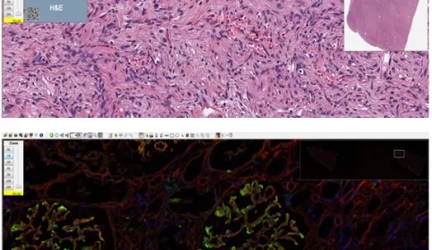 Aperio ImageScope - Pathology Slide Viewing Software