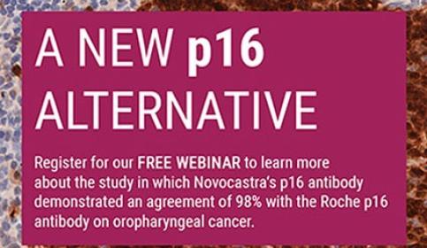 Novocastra p16 antibody demonstrated an agreement of 98% with the Roche p16 antibody 