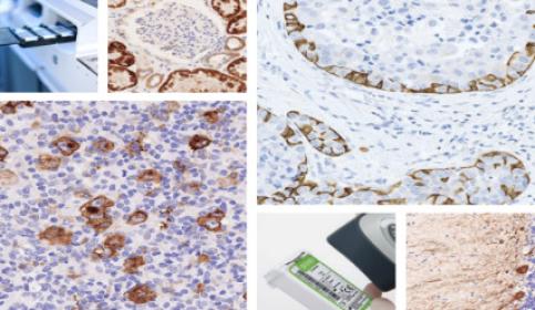 Primary Antibodies for IHC