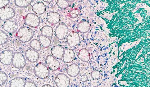 Multiplex Staining 5-Plex