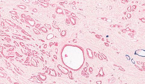 Multiplex Staining 3-Plex