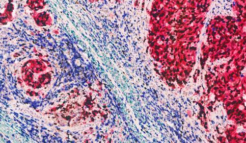 Multiplex Staining 5-Plex