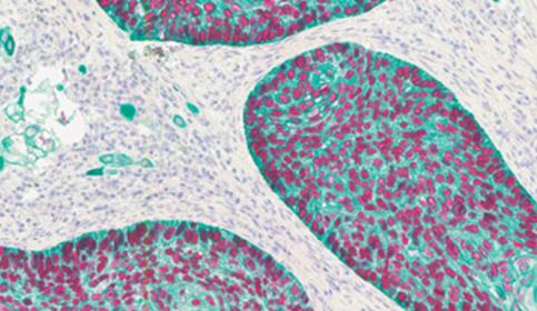 Multiples Staining 2-Plex