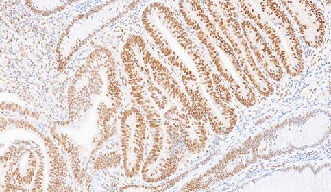 Case-C_MLH1_protein-intact