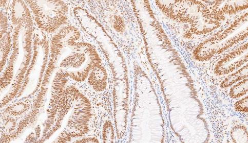 Case-C_PMS2_protein-intact