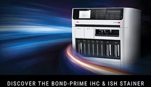 Discover-the-BOND-PRIME-News-promotion-640x410-EN.jpg