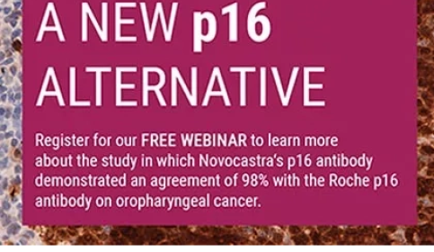 Novocastra p16 antibody demonstrated an agreement of 98% with the Roche p16 antibody