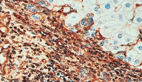 the-european-histopathology-forum-640x410