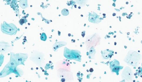 cytology-smear-2-card-640x410.jpg
