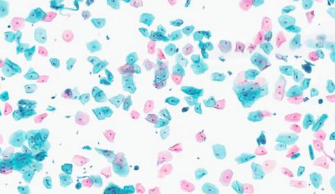 cytology-smear-card-640x410