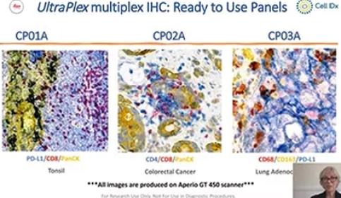 Chromogenic-Multiplex-Biomarker-Profiling-of-Human-FFPE-Tissues-Using-UltraPlex-Technology