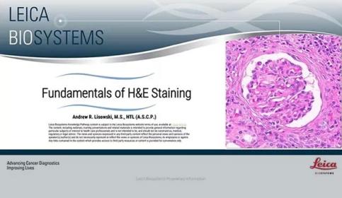 fundamentals-of-h-e-staining-article-640x410