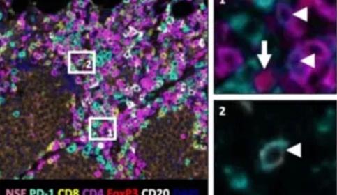 multiplexing-in-tissue-based-research-chromogenic-640x410