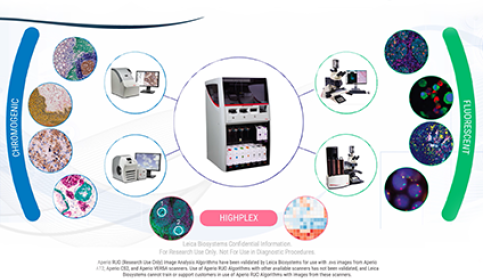 tips-tricks-to-multiplexing-top-5-reasons-to-multiplex-and-chromogenic-versus-thumb