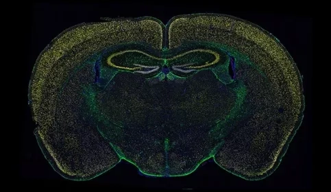 Mouse_brain_Event_Listing_640X410