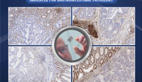 BOND-MMR-Antibody-Panel-250x510