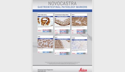 Gastrointestina