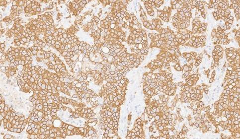 HER2-BMA-RUO-1000x385.jpg