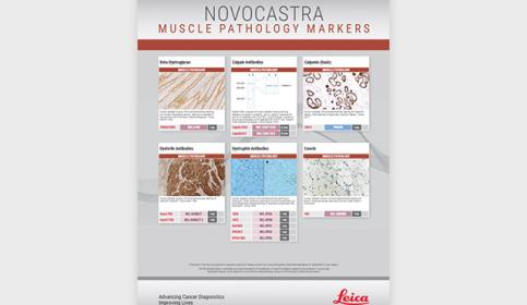 Muscle-Pathology