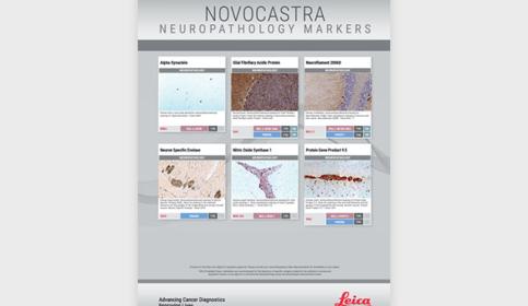 Neuropathology