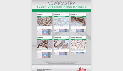 Tumor-Differentiation