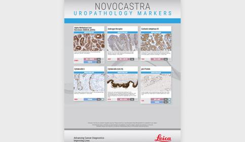 Uropathology