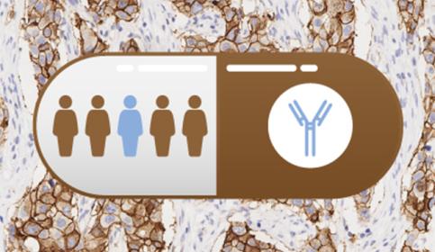 Companion-Diagnostics-in-Precision-Medicine-An-In-Depth-Review-and-Future-Trends-card-640x410