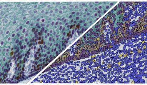 halo-Multiplex-IHC