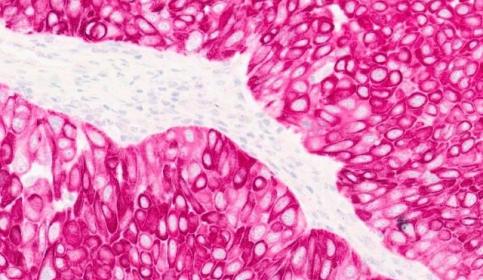 Dual Stain IHC