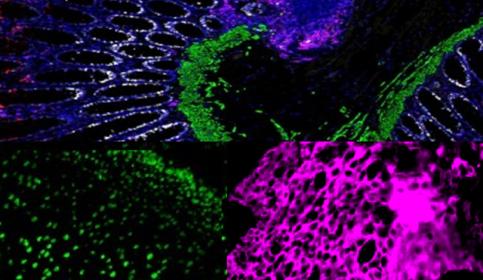 250764 - 2026 Multiplex Webinar Promo Pack