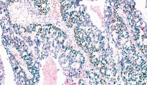 Chromoplex III Tissue from Dana Farber