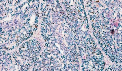 Chromoplex III Tissue from Dana Farber