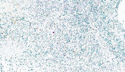 Chromoplex III Tissue from Dana Farber