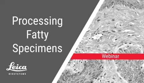 Processing Fatty Specimens Webinar