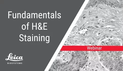 The Fundamentals of H&E Staining Webinar Thumbnail