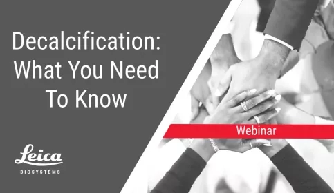Decalcification: What You Need to Know Webinar Thumbnail